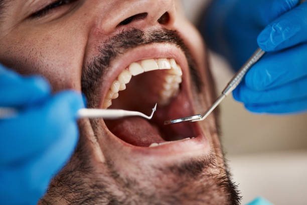 Best Emergency Tooth Extraction in Tunnel Hill, GA